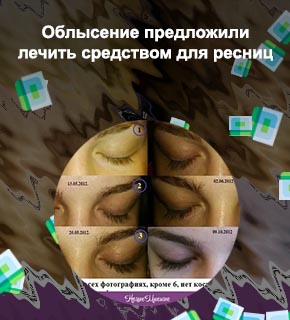 Биматопрост для роста ресниц вред